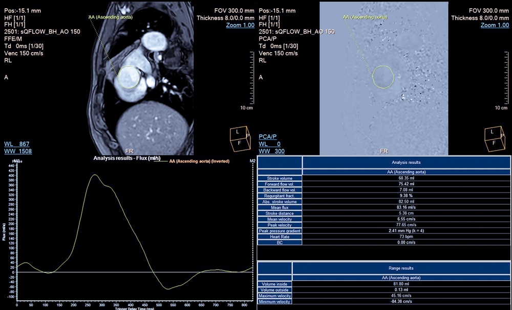 A screenshot featuring MRI scans used to assess injuries from slip and fall accidents.