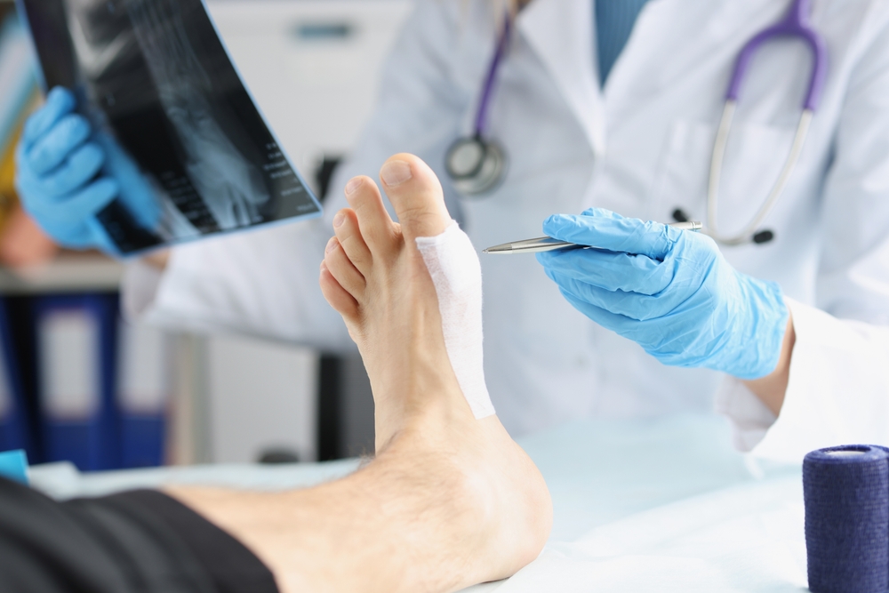 A doctor examines a bandaged foot, focusing on pain management for fall-related injuries.